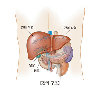 알코올성 간질환