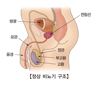 양성 전립선 비대증