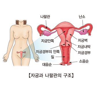 과다월경