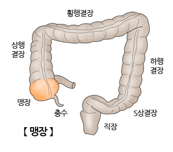 맹장