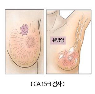 탄수화물 항체 15-3