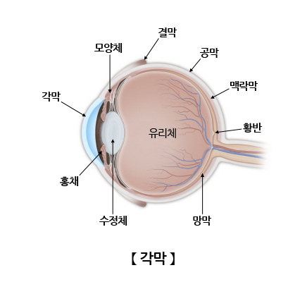 각막